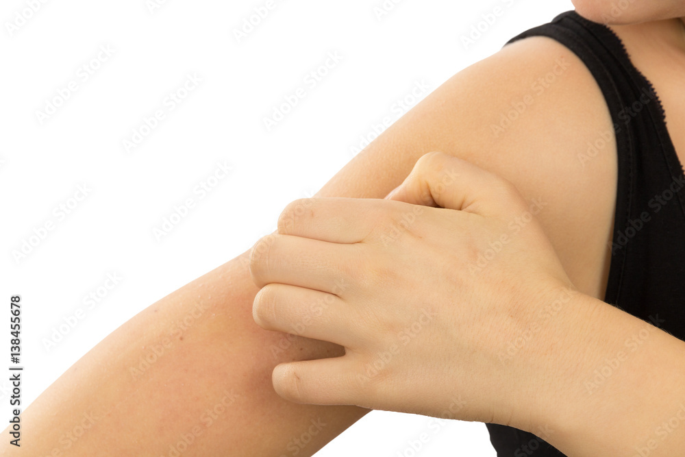 Woman scratching her arm. isolated on ehite background