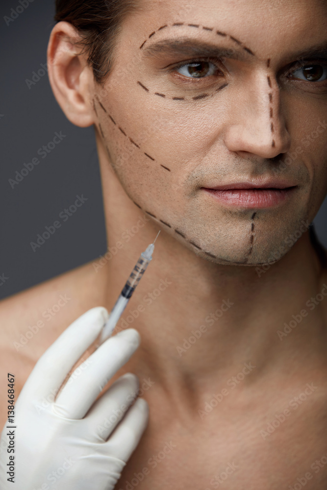 Plastic Surgery. Handsome Man With Face Lines Getting Injections Plastic Surgery. Handsome Man With Face Lines Getting Injections