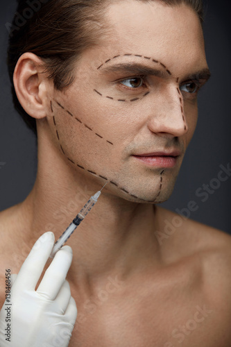 Plastic Surgery. Handsome Man With Face Lines Getting Injections