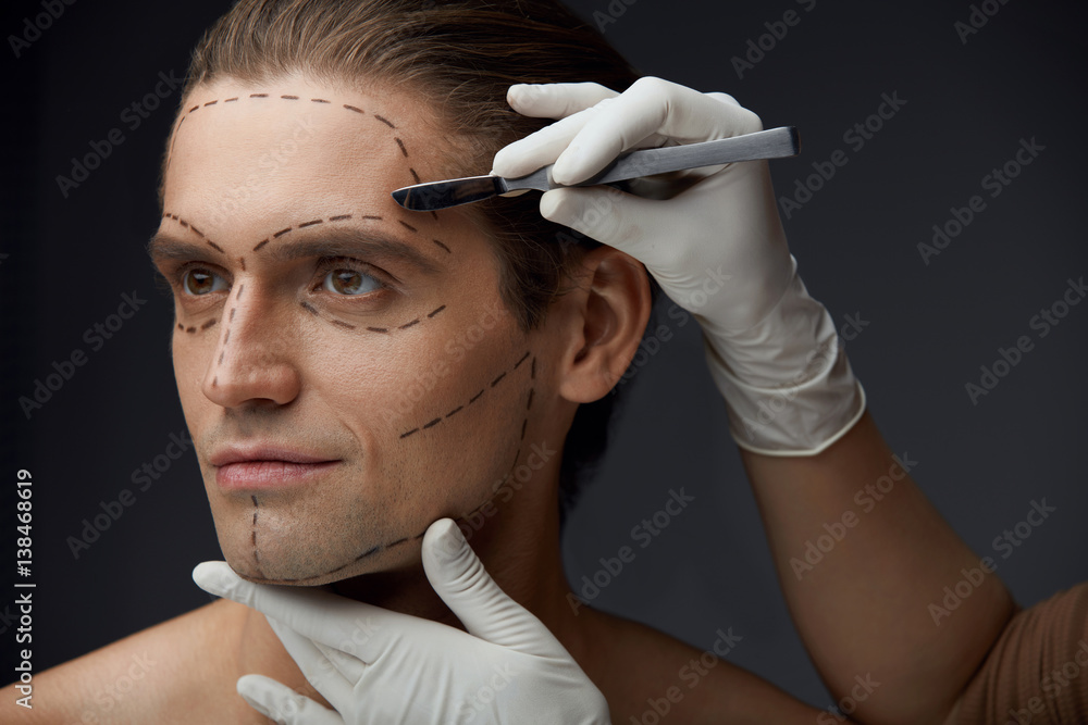 Man With Black Lines On Face Before Plastic Surgery Operation man-with-black-lines-on-face-before-plastic-surgery-operation