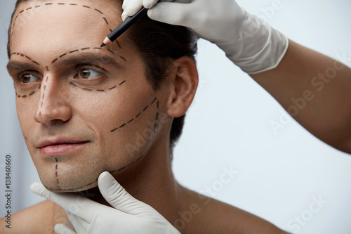 Close Up Of Man Face With Black Lines Before Beauty Operation photo