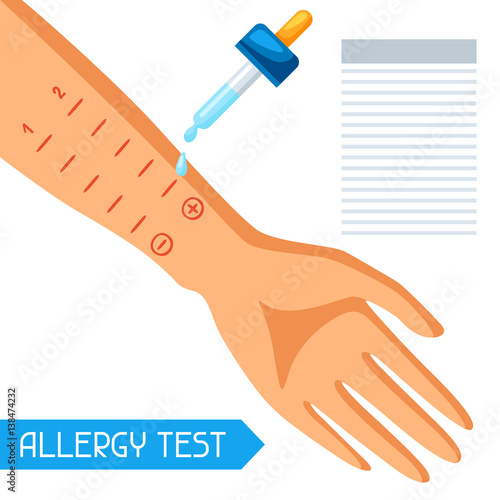 Allergy test. Vector illustration for medical websites advertising medications