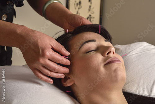Acupuncture Hands On Head Chinese Medicine