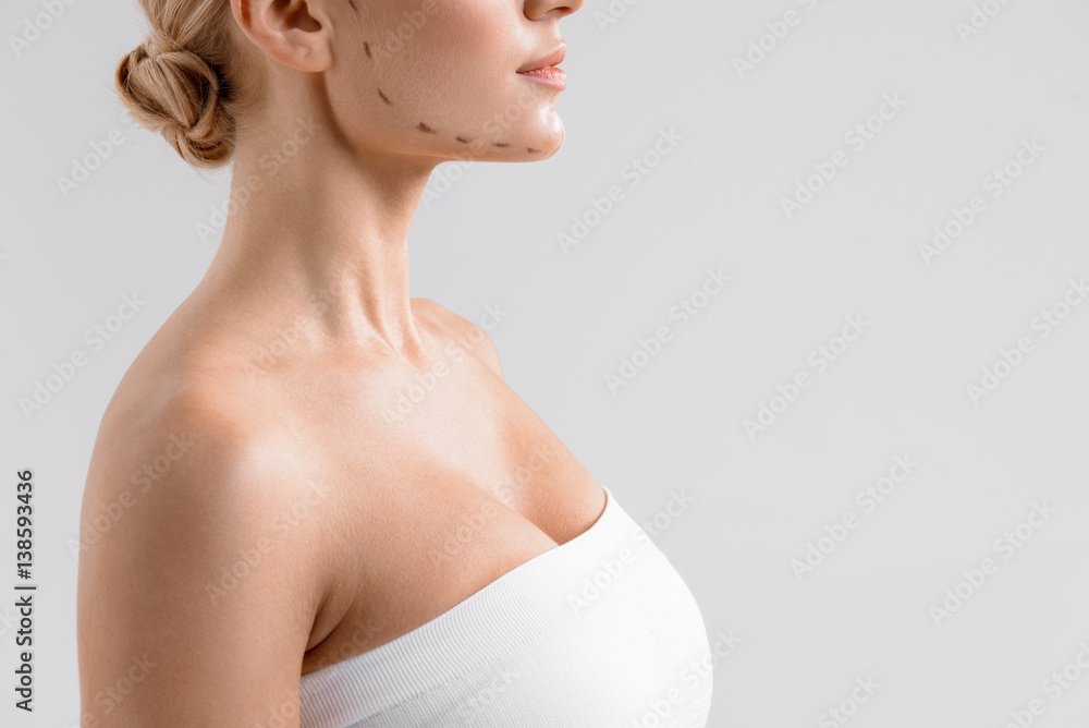 Fototapeta premium Slim lady preparing for plastic surgery operation