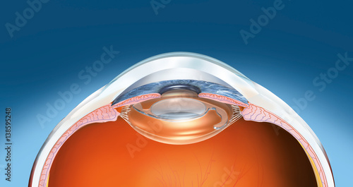 Human eye with artifical lens, medical illustration photo