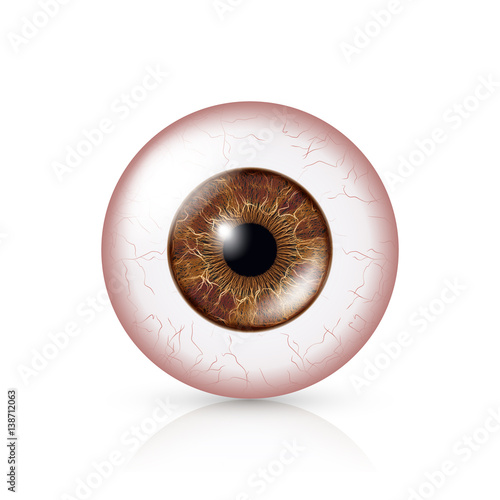 Conjunctivitis. Red Eye. Human Eyeball With Conjunctivitis. Vector Illustration