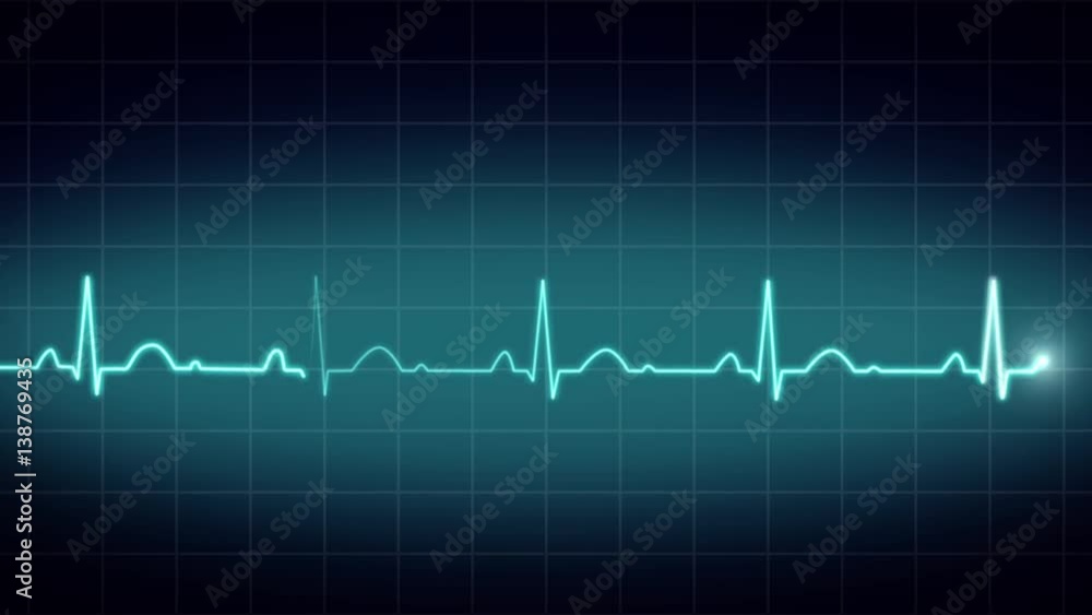 Animated EKG Display Animated EKG Display