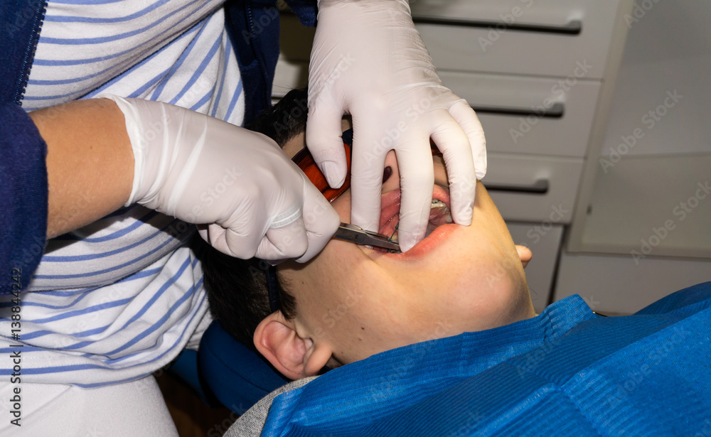 Obraz premium boy in dental treatment. brace. health care