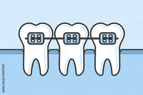 Teeth with dental braces vector illustration