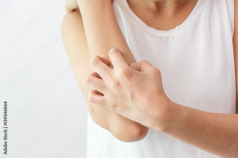 Women scratch the itch with hand / arm itching / Concept with Healthcare And Medicine. Women scratch the itch with hand / arm itching / Concept with Healthcare And Medicine.