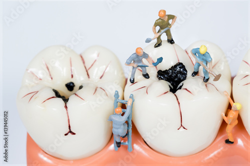 Fototapeta Naklejka Na Ścianę i Meble -  miniature people clean tooth model,medical concept
