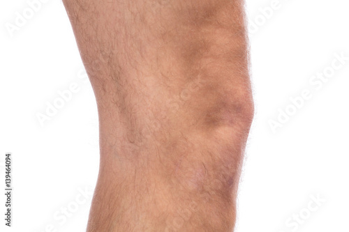 Knie eines Mannes