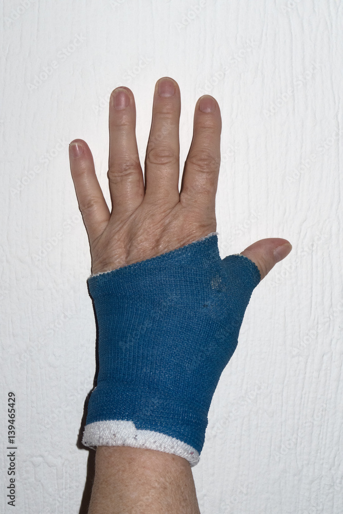 Gips Hand Stock-foto | Adobe Stock