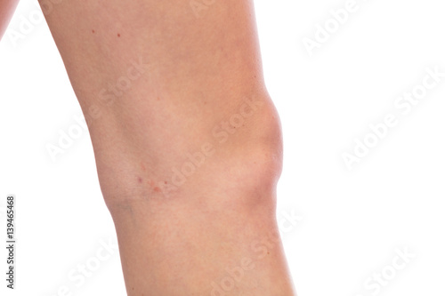 Knie einer Frau