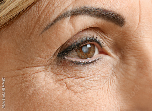 Foto Cataract concept. Senior woman's eye, closeup