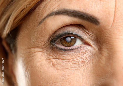 Cataract concept. Senior woman's eye, closeup photo