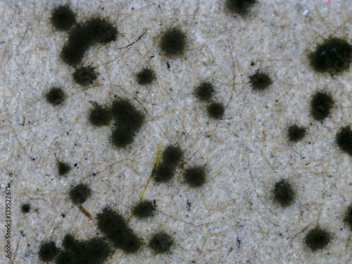 Schimmel unter Mikroskop - Stachybotrys