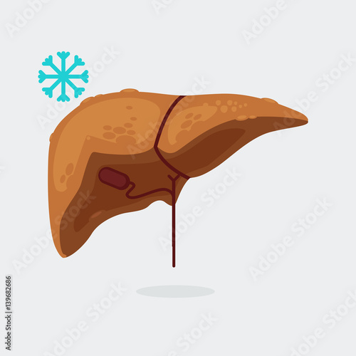 liver cirrhosis vector illustration