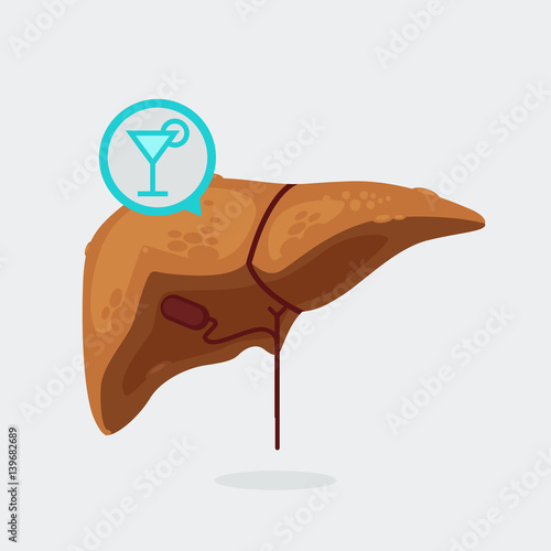 liver cirrhosis vector illustration