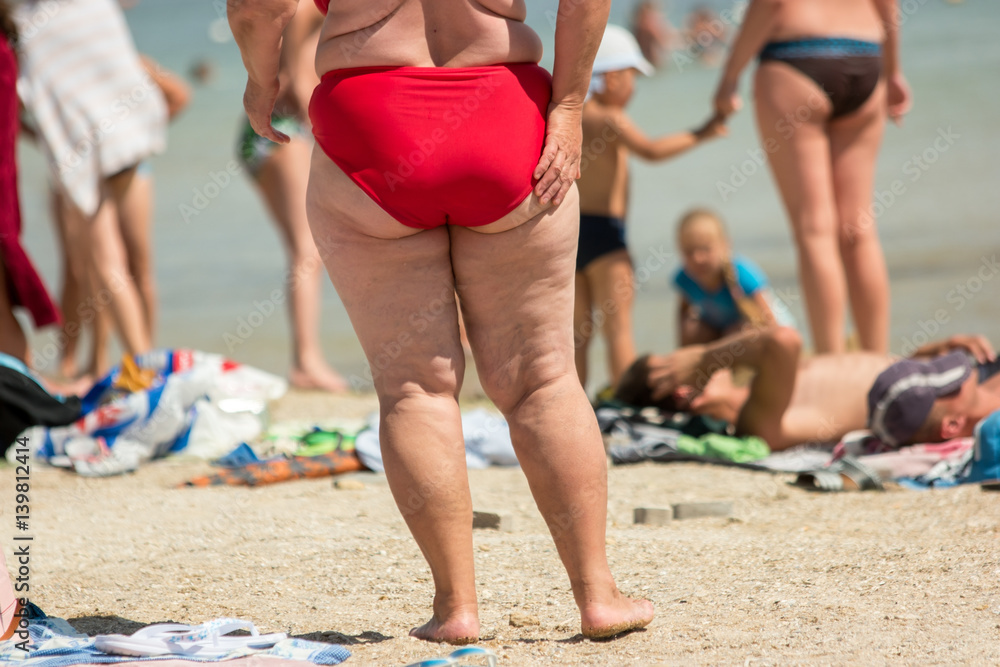 Legs of overweight lady. Fat woman on the beach. Aftermath of poor diet. Serious problems with metabolism.