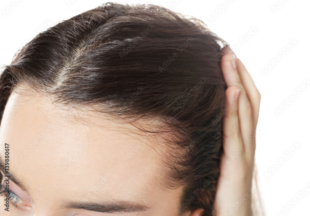 Young woman with hair loss problem on white background, closeup Young woman with hair loss problem on white background, closeup