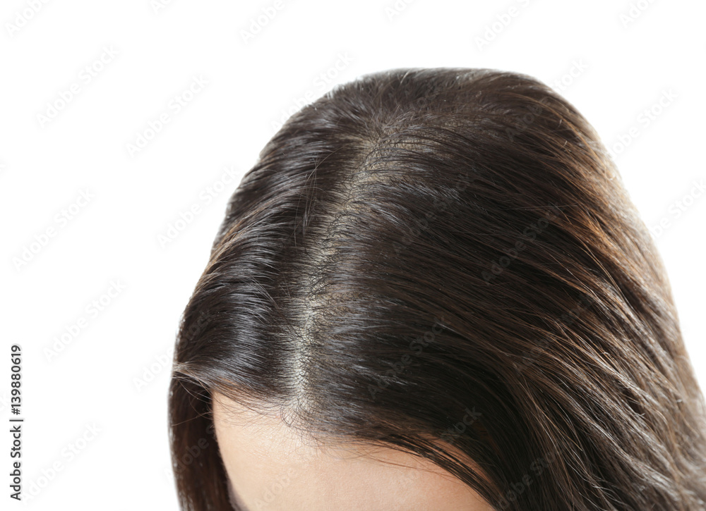 Young woman with hair loss problem on white background, closeup Young woman with hair loss problem on white background, closeup