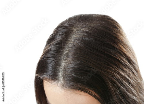 Young woman with hair loss problem on white background, closeup