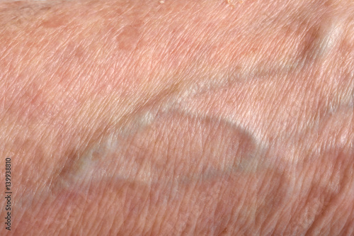 Detail of texture skin senior woman