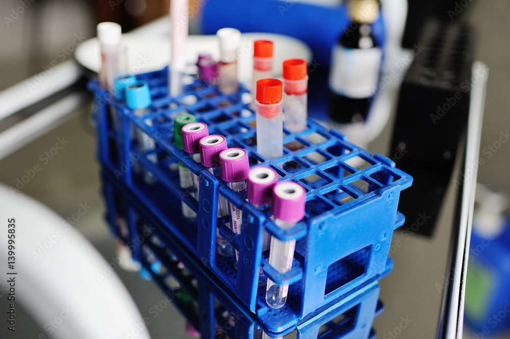 Multicolored tubes of blood close-up on a background of polyclinics Multicolored tubes of blood close-up on a background of polyclinics