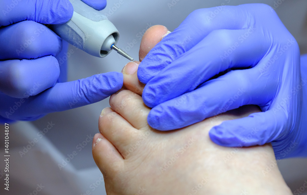 Pedicure specialist works with the patient in clinic Pedicure specialist works with the patient in clinic