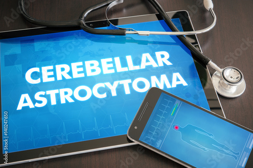 Cerebellar astrocytoma (cancer type) diagnosis medical concept on tablet screen with stethoscope