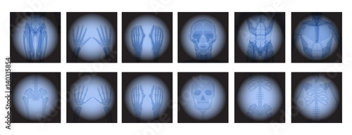 X Ray radiology set. Healthcare. Treatment for internal oragns and bones.