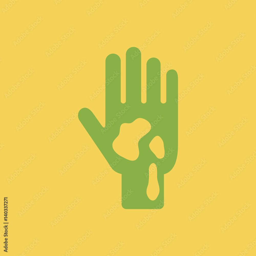 allergic stains on hand, various symptoms of Malaria on the human allergic stains on hand, various symptoms of Malaria on the human