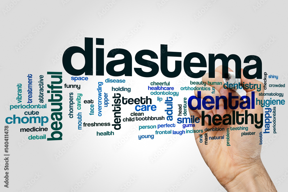 Diastema word cloud Diastema word cloud