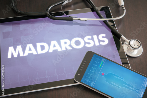 Madarosis (cutaneous disease) diagnosis medical concept on tablet screen with stethoscope photo