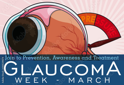 Eyeball with Manometer to Commemorate Glaucoma Week, Vector Illustration