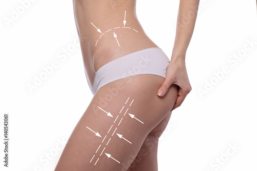 Female body with the arrows drawing on it. Fat lose, liposuction and cellulite removal concept. Sport, fitness, Dieting results.