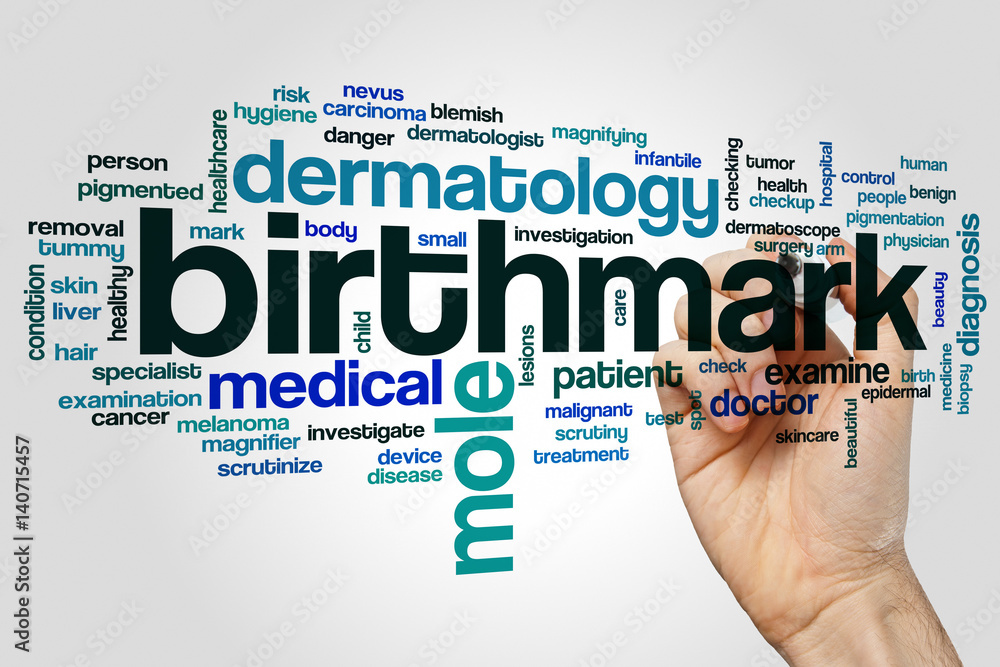 Birthmark word cloud concept on grey background Birthmark word cloud concept on grey background