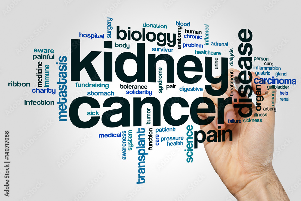 Kidney cancer word cloud