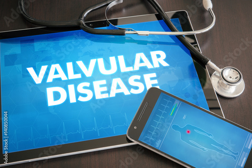Valvular disease (cardiology related) diagnosis medical concept on tablet screen with stethoscope photo