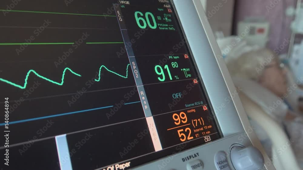 Quick pan to a heart monitor Quick pan to a heart monitor