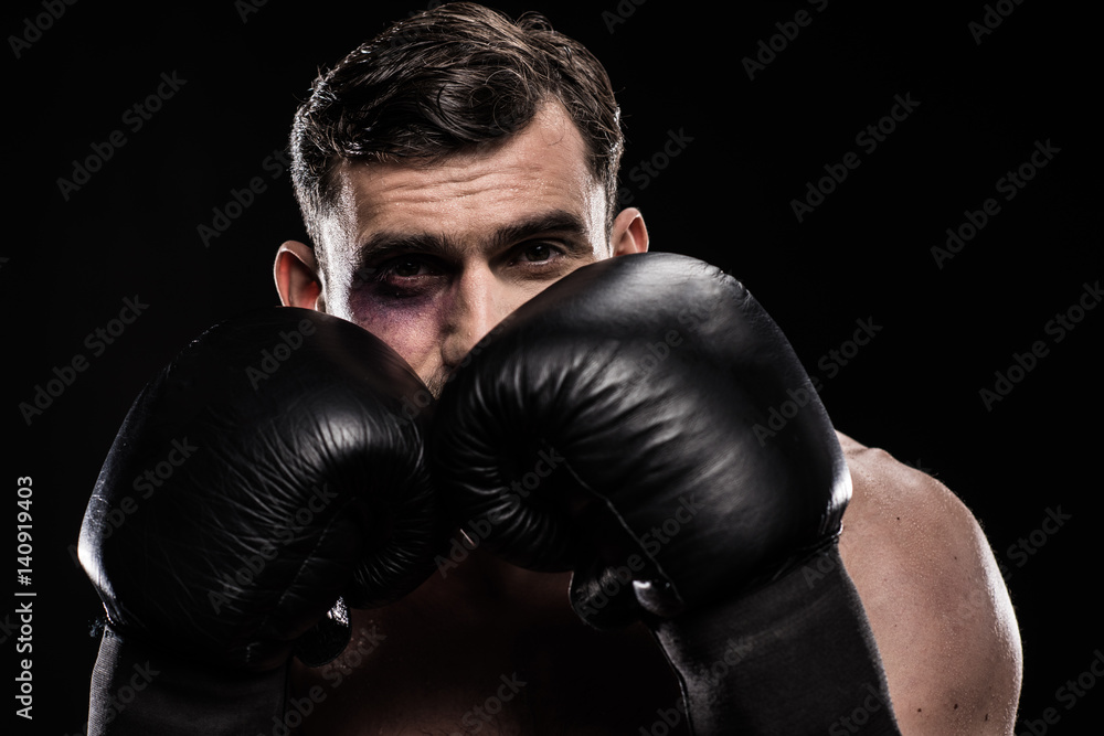 Boxer with black eye