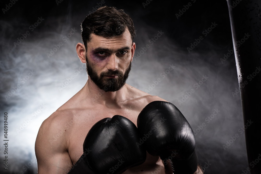 Boxer with black eye