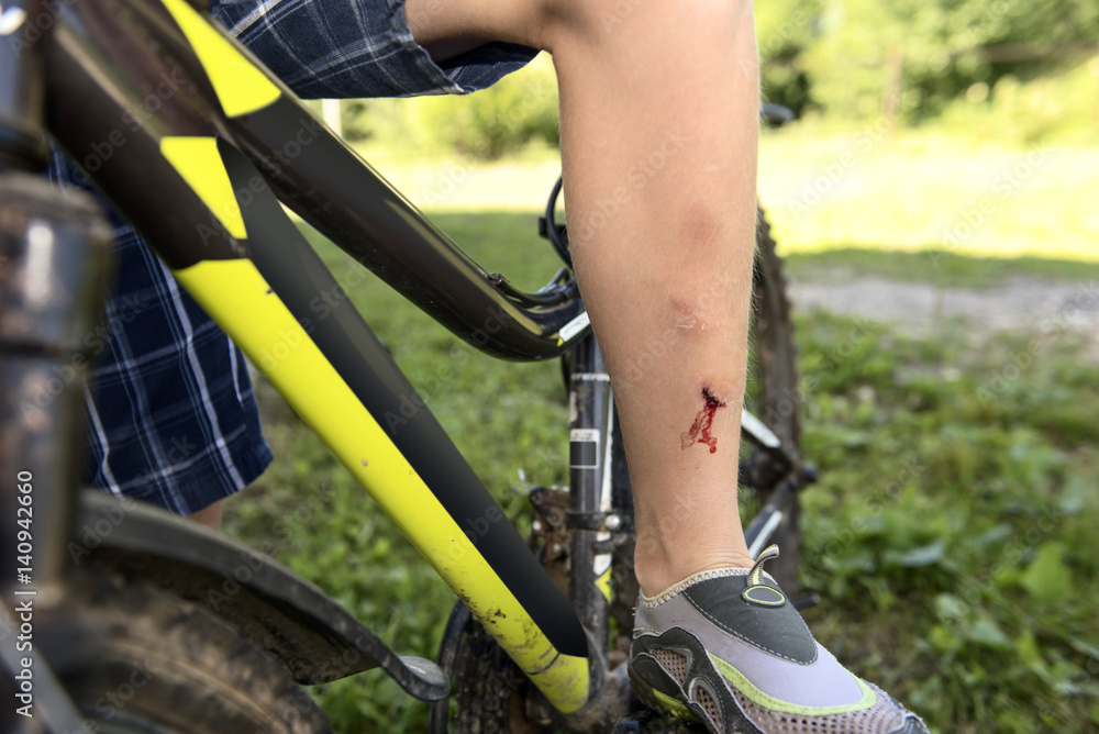 Naklejka premium Teenager has fallen from bicycle and was traumatized