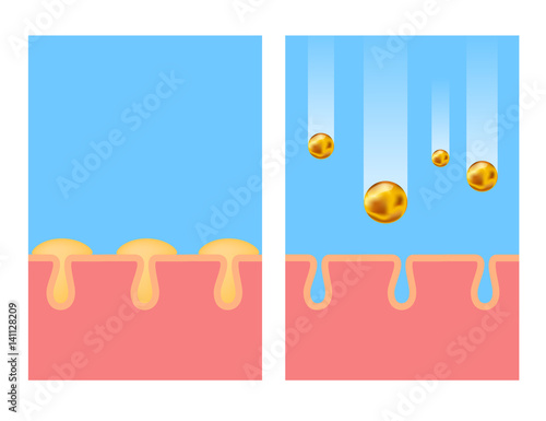 oil control vector . oily skin