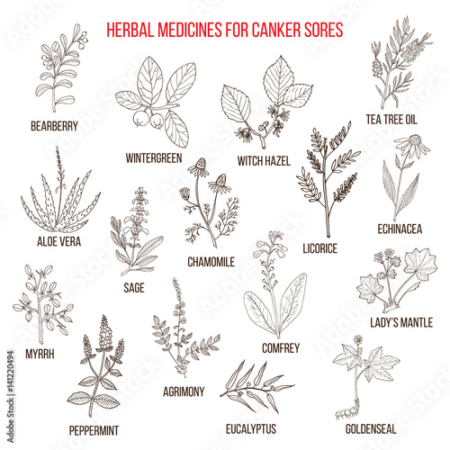 Best herbal remedies for canker sores