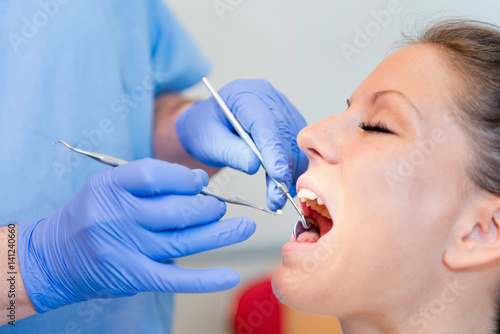 Dental filling