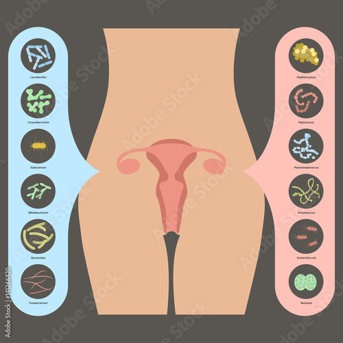 Gynecology Vector illustration. Womans vaginal flora or microbiota in vagina, Good and Bad Bacteria photo