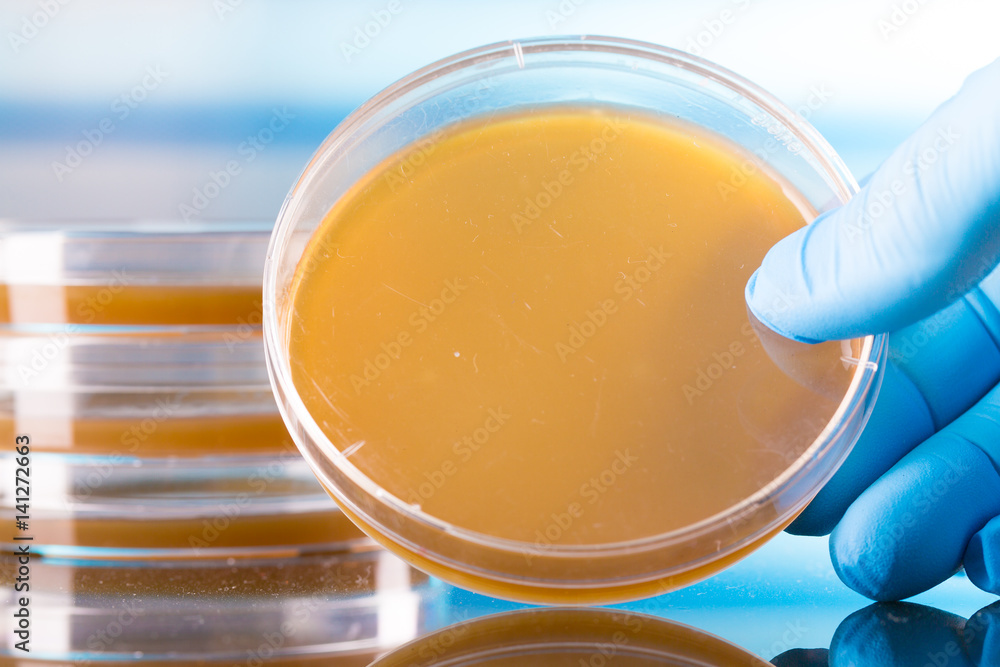 Petri dish in medical laboratory Petri dish in medical laboratory