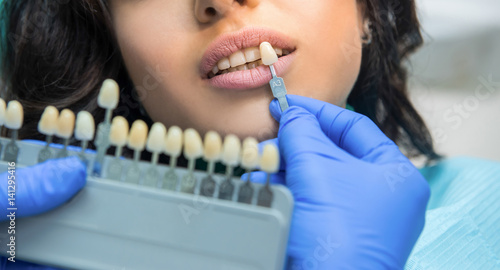 Patient and tooth whitening chart. Face of young woman.